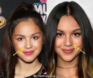 does olivia rodrigo have implants|Sneaky plastic surgeries used by celebs to look better than you